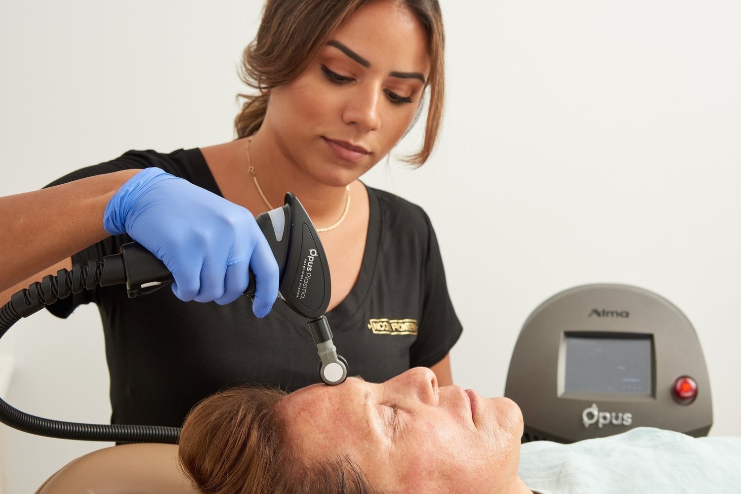 Opus Plasma: The Future of Skin Resurfacing for Radiant, Rejuvenated Skin