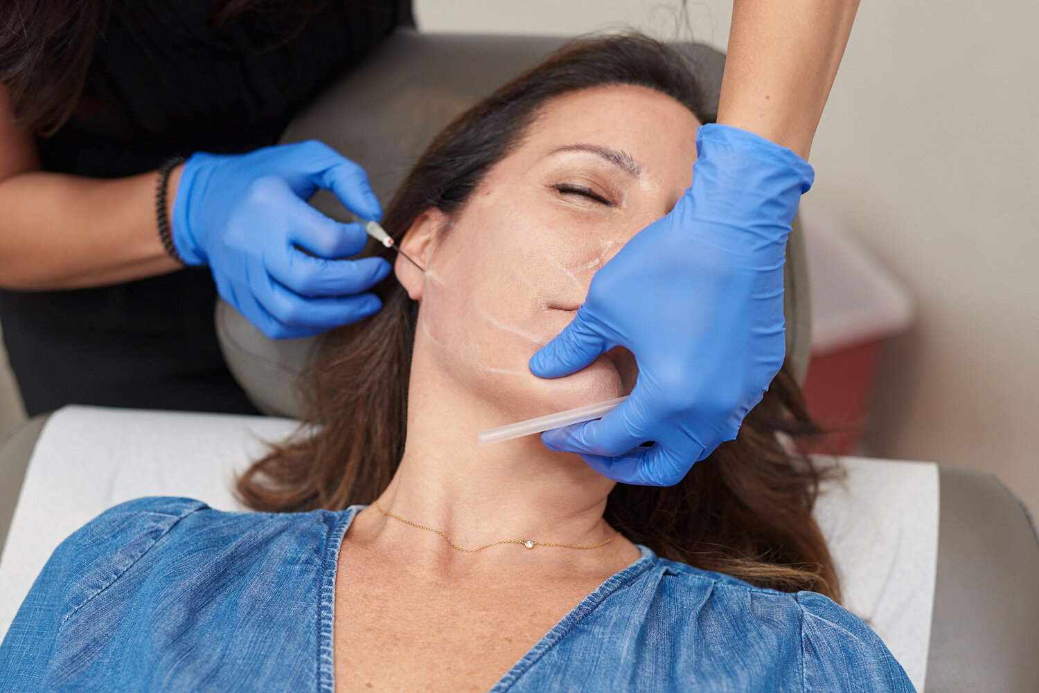 The Art of Injectables: How to Achieve Natural, Beautiful Results