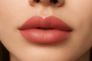 Plump lips after lip filler treatment