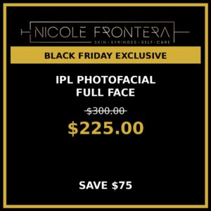 IPL Photofacial Full Face - $225 (Save $75!) - Black Friday Special
